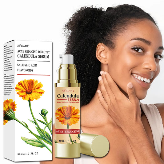 Afcare Calendula Acne Reducing Serum with Salicylic Acid